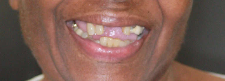Before